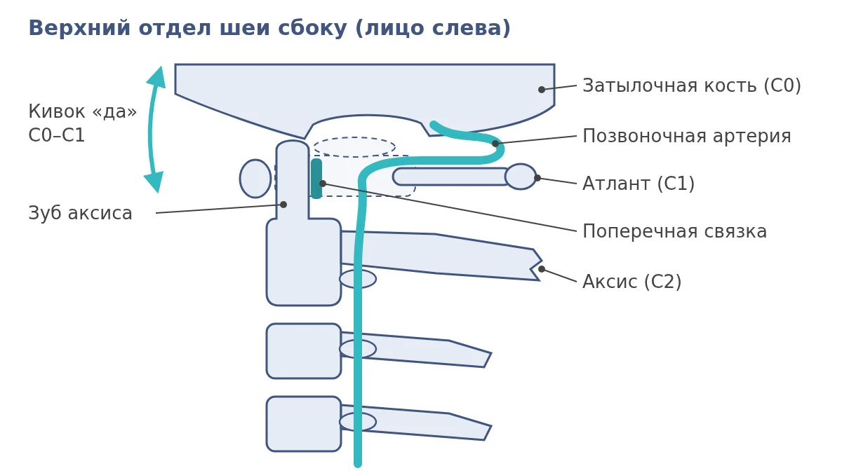Схема верхнего отдела шеи сбоку: затылочная кость, атлант C1, аксис C2 с зубом, поперечная связка и позвоночная артерия на задней дуге атланта