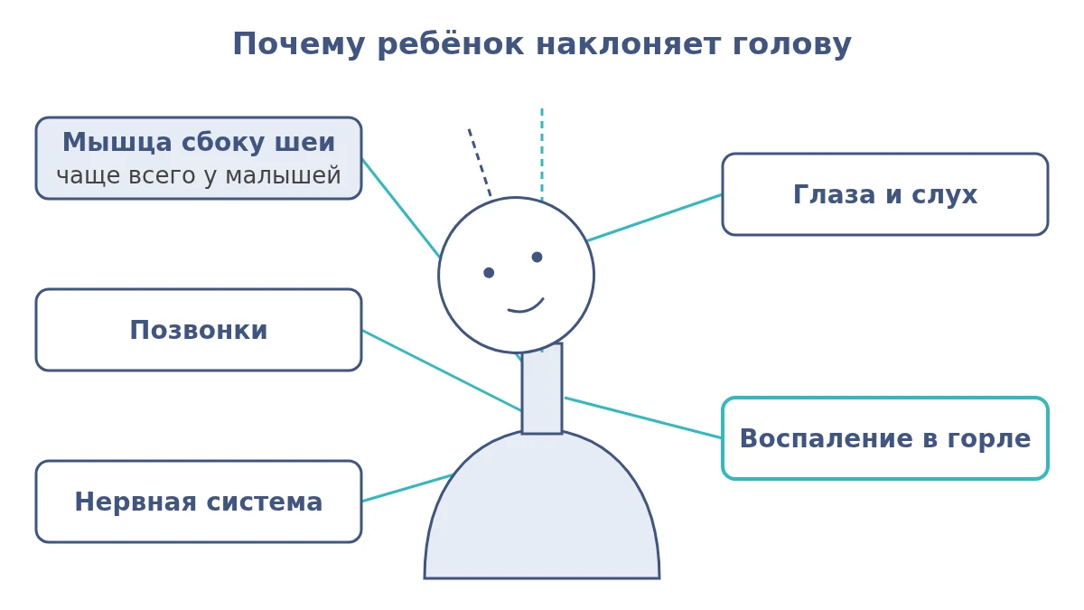 Схема причин наклона головы у ребёнка: мышца шеи, позвонки, глаза и слух, воспаление в горле, нервная система