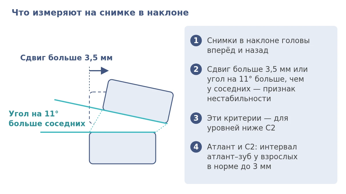 Схема функционального рентгена шеи: сдвиг позвонка больше 3,5 мм и разница угла больше 11 градусов ниже C2, интервал атлант–зуб у взрослых до 3 мм