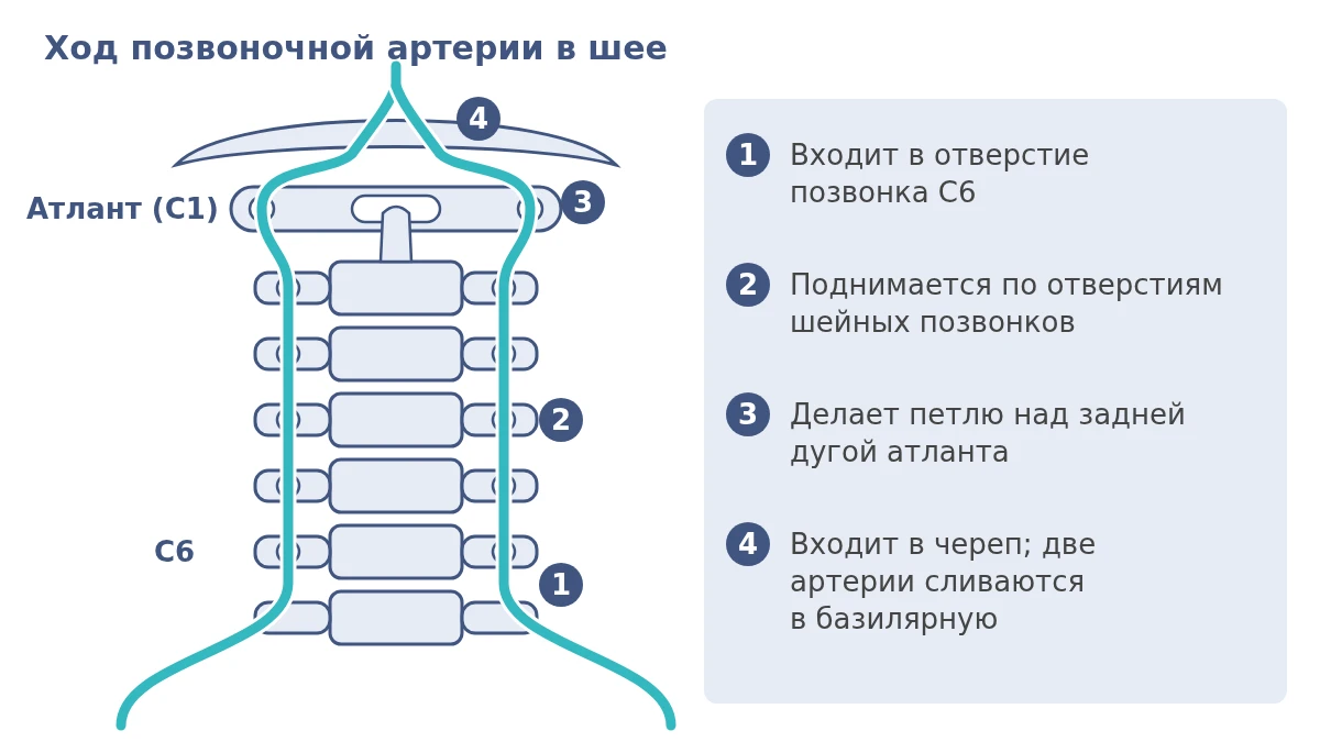 Схема хода позвоночной артерии: вход в отверстие позвонка C6, подъём по отверстиям шейных позвонков, петля над атлантом C1 и вход в череп